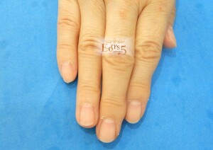 32